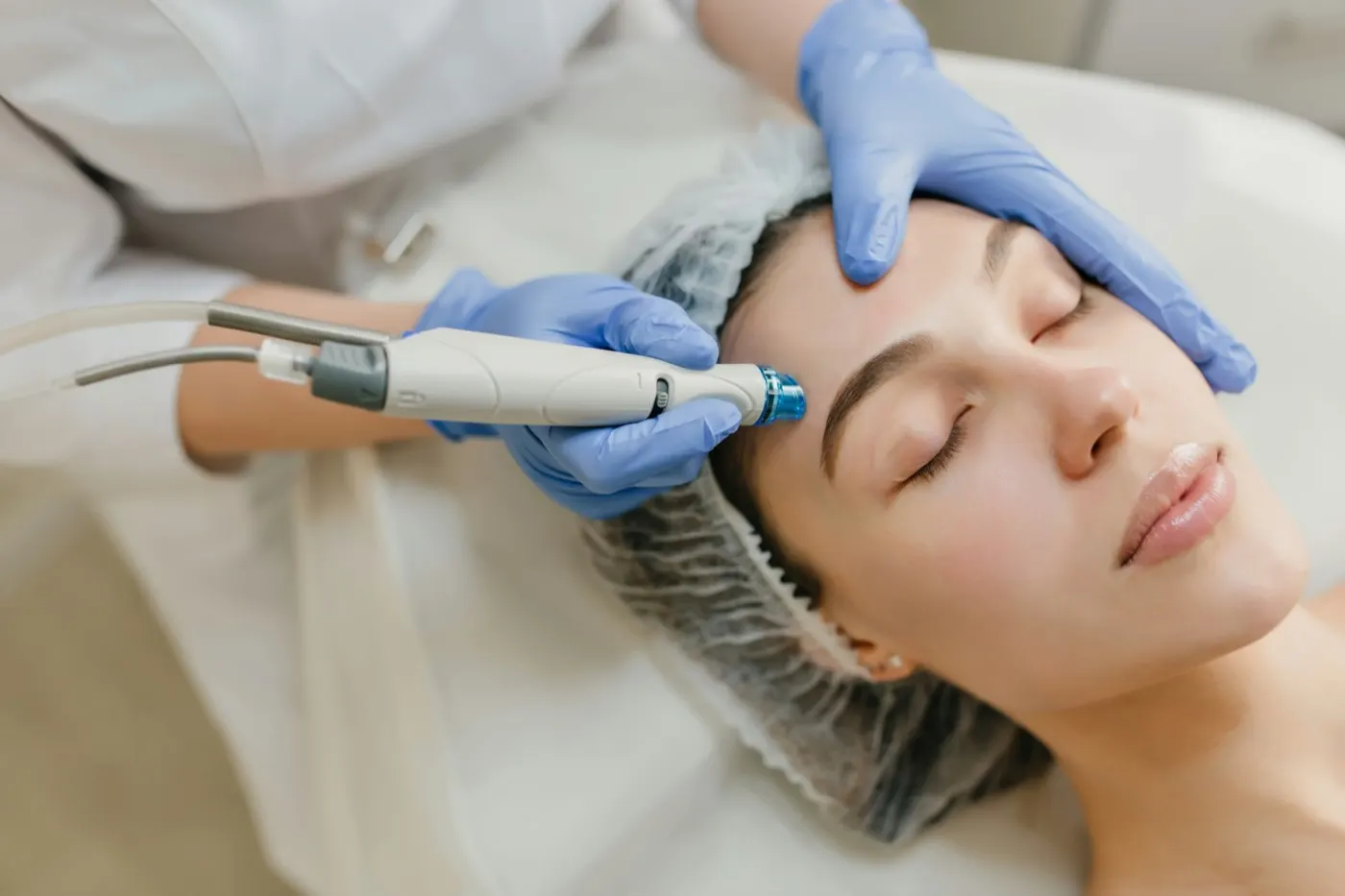 Tratamento de manchas e melasma
