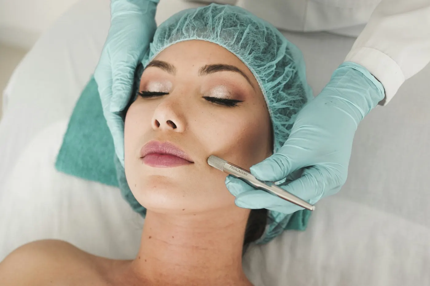 Tratamento de acne