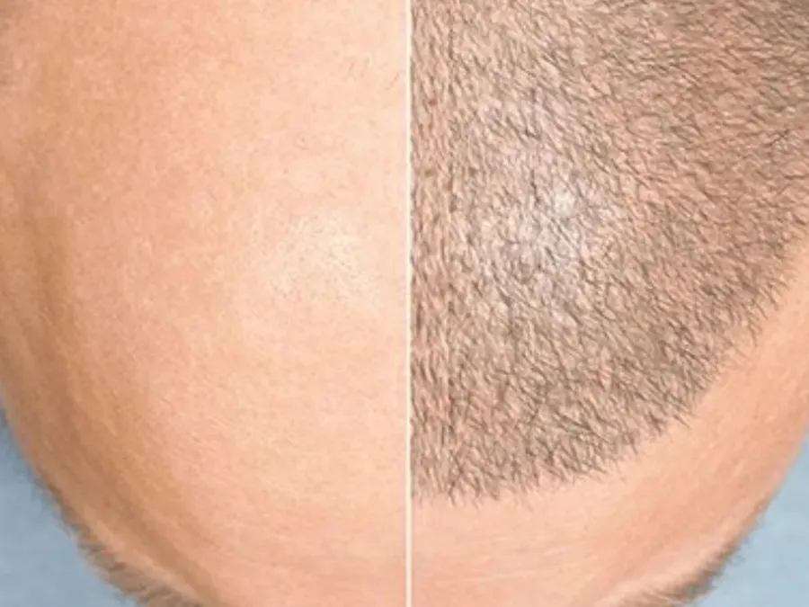 Desenho de linha frontal